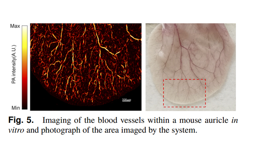 微片激光器在光声成像中的应用